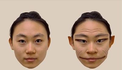 “사람 얼굴, 피카소 그림처럼 찌그러져 보여”… 전세계 100건 보고된 희귀병, 뭘까?
